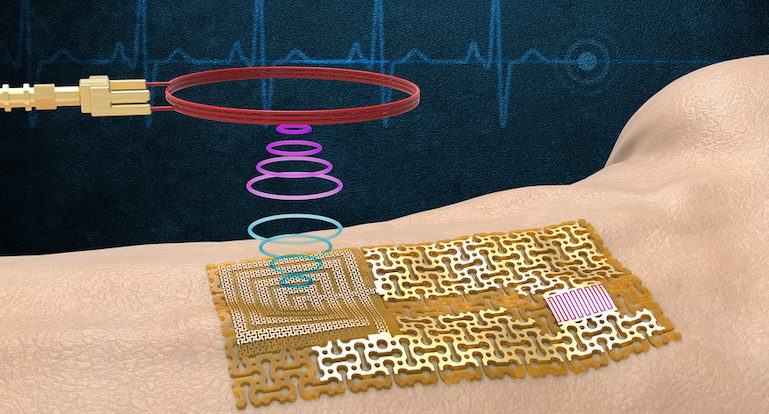 chip-free wireless electronic skin