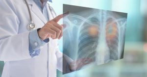 Inhalable point-of-care urinary diagnostic platform