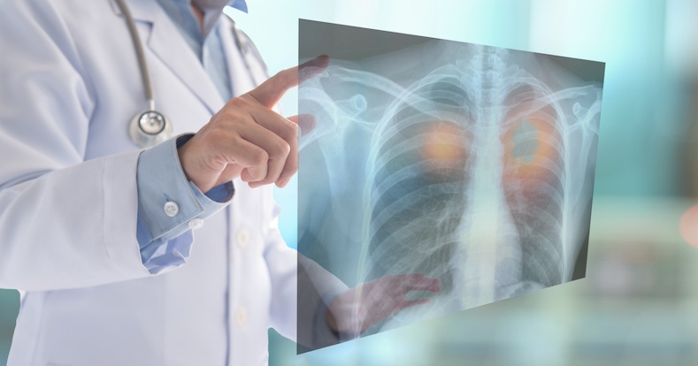 Inhalable point-of-care urinary diagnostic platform